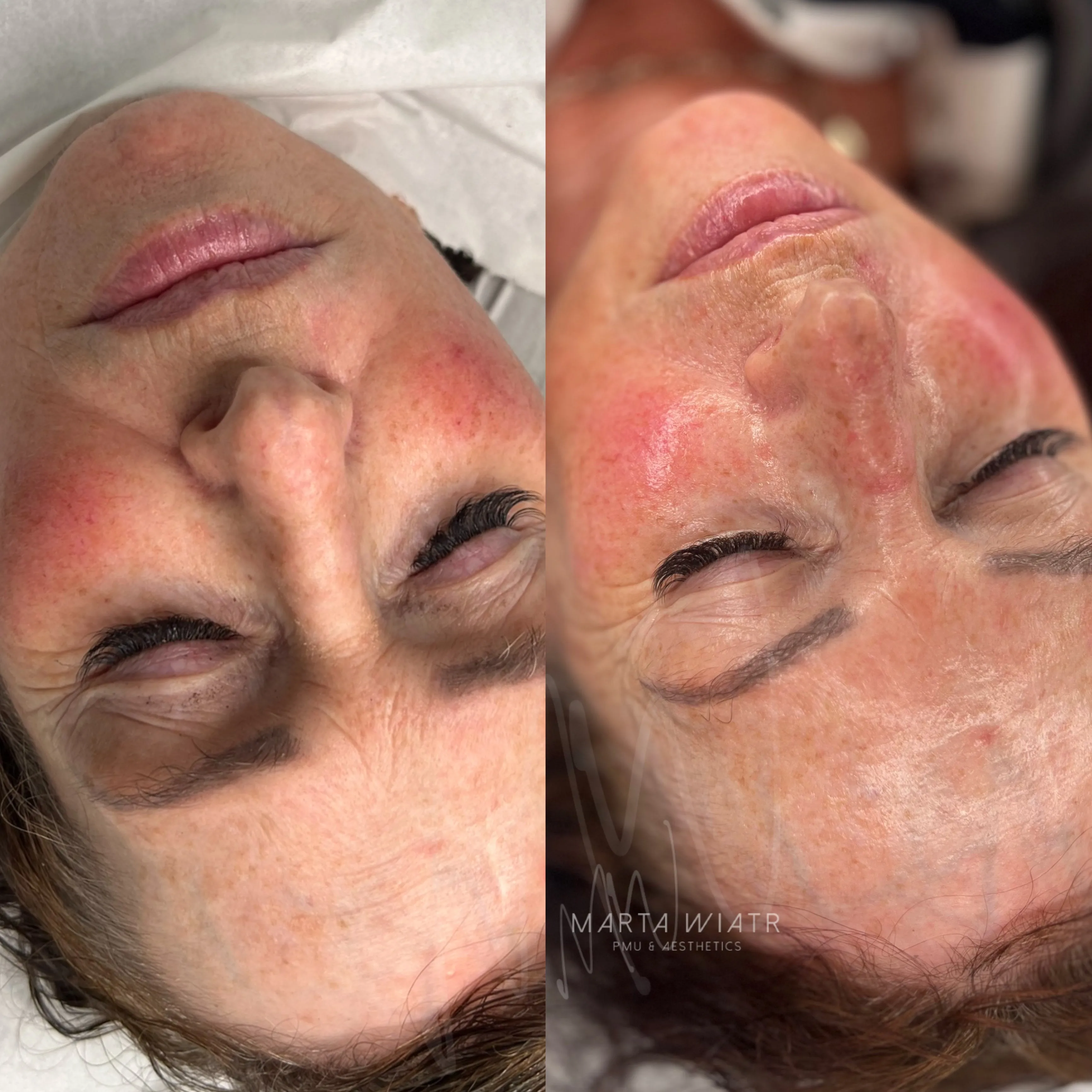 TAILORED SKINCARE TREATMENTS / KOREAN FACIAL